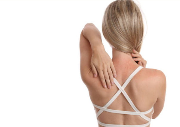 Ronchas en la piel: ¿Por qué aparecen?