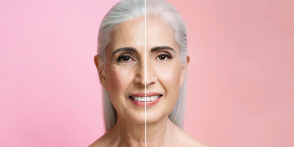 Cómo quitar las patas de gallo