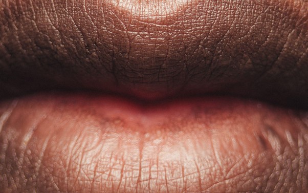 Labios cortados en invierno, ¿Cómo tratarlos?