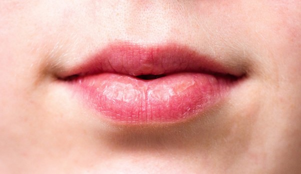 Labios cortados en invierno, ¿Cómo tratarlos?
