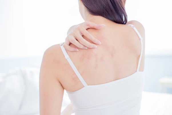 Dermatitis Nerviosa: ¿Qué es?