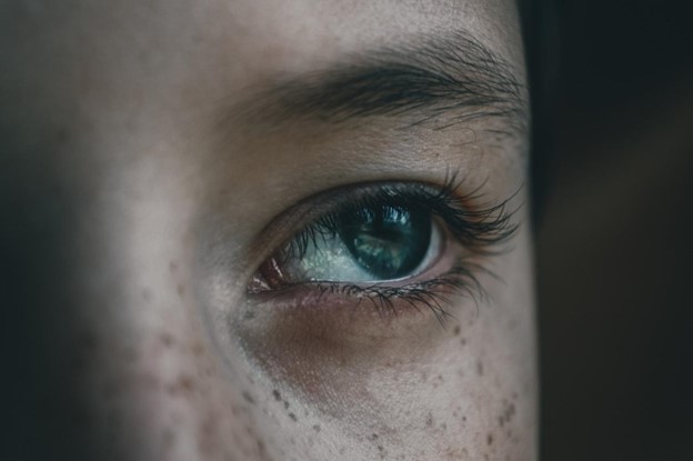 Pecas: ¿Qué significado tienen en tu piel?