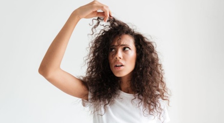 Alopecia femenina: qué es y cómo tratarla