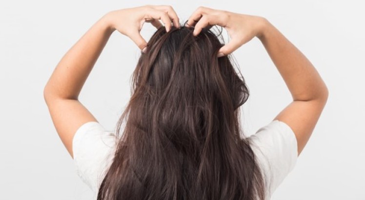 ¿Cómo calmar el picor en el cuero cabelludo?