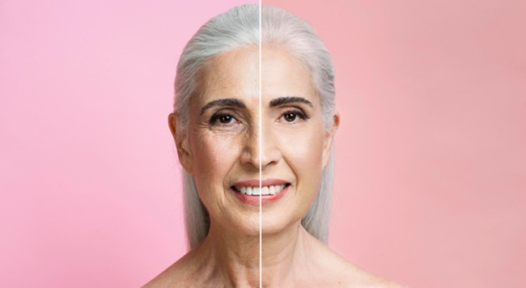 Retinol y Ácido retinoico para la piel: el secreto para una piel radiante