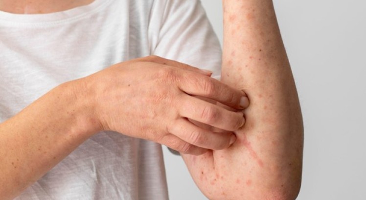 Dermatitis en el cuello: causas y tratamientos