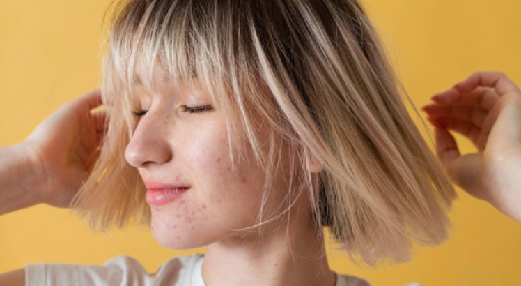 Cómo quitar manchas en la cara: opciones y consejos