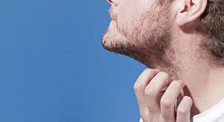 ¿Cómo quitar la caspa de la barba? 