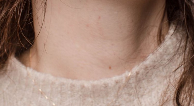 ¿Qué puedo hacer contra las verrugas del cuello y las axilas?